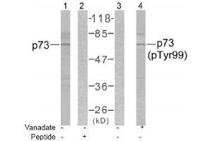Image no. 1 for anti-Tumor Protein P73 (TP73) (Tyr99) antibody (ABIN197232)