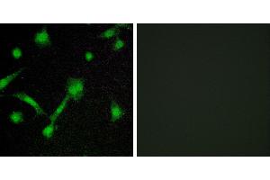 P-peptide - +Immunofluorescence analysis of LOVO cells, using IκB-α (Phospho-Ser32/Ser36) antibody. (NFKBIA antibody  (pSer32, pSer36))