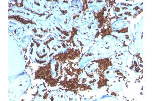 Formalin-fixed, paraffin-embedded human Placenta stained with Glycophorin A Recombinant Rabbit Monoclonal Antibody (GYPA/3219R).