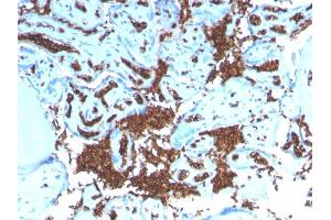 Formalin-fixed, paraffin-embedded human Placenta stained with Glycophorin A Recombinant Rabbit Monoclonal Antibody (GYPA/3219R). (Recombinant CD235a/GYPA antibody)