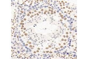 Immunohistochemistry analysis of paraffin-embedded mouse testis using,PSIP1 (ABIN7074997) at dilution of 1: 3000 (PSIP1 antibody)