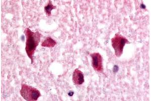 Immunohistochemistry (IHC) image for anti-Nuclear Receptor Subfamily 2, Group E, Member 1 (NR2E1) (N-Term) antibody (ABIN1049135)