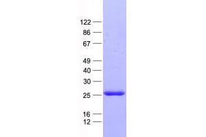 Western Blotting (WB) image for Translocase of Inner Mitochondrial Membrane 23 Homolog (Yeast) (TIMM23) protein (His tag) (ABIN2733741)