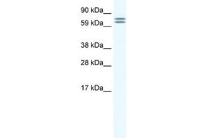 WB Suggested Anti-CES6 Antibody Titration:  1. (CES4A antibody  (Middle Region))