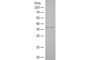 Western Blotting (WB) image for Phosphatidylinositol Glycan Anchor Biosynthesis, Class Z (PIGZ) (AA 431-579) protein (His-IF2DI Tag) (ABIN7282735) (PIGZ Protein (AA 431-579) (His-IF2DI Tag))