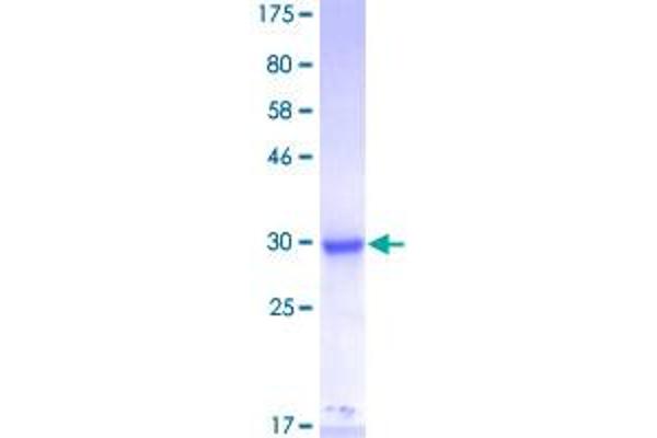 MED27 Protein (AA 1-70) (GST tag)