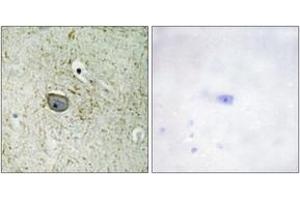 Immunohistochemistry analysis of paraffin-embedded human brain tissue, using PDGFR alpha (Ab-762) Antibody. (PDGFRA antibody  (AA 731-780))