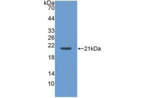Western blot analysis of recombinant Human MGA. (AGLU antibody  (AA 213-392))