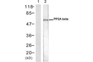 Western blot analysis of extracts from 293 cells using PP2A-beta antibody (E021404, Lane 1 and 2). (PPP2CB antibody)
