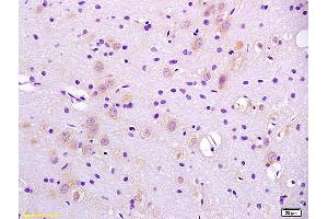 Formalin-fixed and paraffin embedded rat brain labeled with Anti-CaIPLA2/PLA2G6 Polyclonal Antibody, Unconjugated (ABIN720281) at 1:200 followed by conjugation to the secondary antibody and DAB staining.