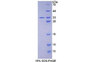 SDS-PAGE (SDS) image for Complement Component 1, Q Subcomponent Binding Protein (C1QBP) (AA 76-282) protein (His tag) (ABIN1079882)