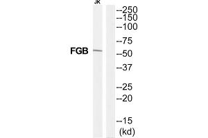 Western Blotting (WB) image for anti-Fibrinogen beta Chain (FGB) (C-Term) antibody (ABIN1852788) (Fibrinogen beta Chain antibody  (C-Term))