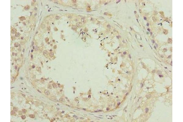 ZNF622 antibody  (AA 2-280)