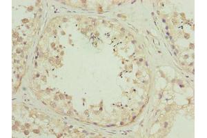 Immunohistochemistry of paraffin-embedded human testis tissue using ABIN7176441 at dilution of 1:100 (ZNF622 antibody  (AA 2-280))