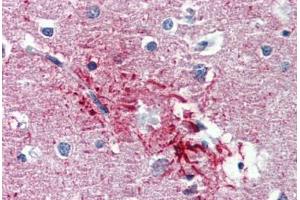 Human Brain, Cortex, Senile Plaque (formalin-fixed, paraffin-embedded) stained with HMGN1 antibody ABIN462182 followed by biotinylated goat anti-rabbit IgG secondary antibody ABIN481713, alkaline phosphatase-streptavidin and chromogen. (HMGN1 antibody  (AA 36-85))