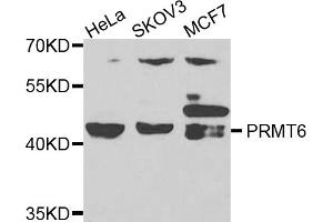 Western blot analysis of extracts of various cell lines, using PRMT6 antibody. (PRMT6 antibody)