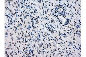Immunohistochemical staining of paraffin-embedded colon tissue using anti-L1CAMmouse monoclonal antibody. (L1CAM antibody)