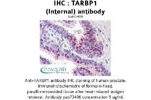 Image no. 1 for anti-TAR (HIV-1) RNA Binding Protein 1 (TARBP1) (Internal Region) antibody (ABIN1739905) (TARBP1 antibody  (Internal Region))