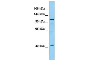 Host: Rabbit Target Name: DHTKD1 Sample Type: 293T Whole Cell lysates Antibody Dilution: 1. (DHTKD1 antibody  (N-Term))