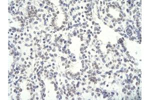 Rabbit Anti-NFYC antibody        Paraffin Embedded Tissue:  Human Lung cell   Cellular Data:  Epithelial cells of renal tubule  Antibody Concentration:   4. (NFYC antibody  (C-Term))