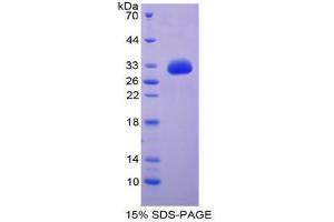 SDS-PAGE analysis of Human GDF11 Protein. (GDF11 Protein)