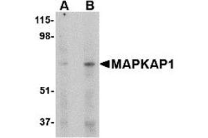 Western Blotting (WB) image for anti-Mitogen-Activated Protein Kinase Associated Protein 1 (MAPKAP1) (Middle Region) antibody (ABIN1030995) (MAPKAP1 antibody  (Middle Region))