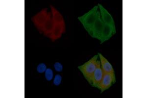 ABIN6260435 and ABIN6272263 staining Hela cells(24h of starvation treatment) by IF/ICC. (CaMK2 beta/gamma antibody  (C-Term))