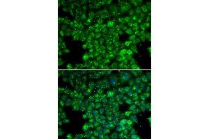 Immunofluorescence analysis of U20S cell using LYZL6 antibody. (LYZL6 antibody  (AA 20-148))
