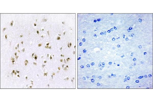 HMGN2 antibody