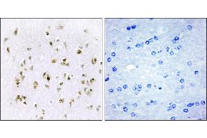 Immunohistochemistry analysis of paraffin-embedded human brain tissue, using HMG17 antibody. (HMGN2 antibody)