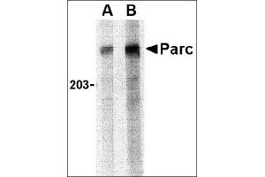Western blot analysis of PARC in Daudi lysate with this product at (A) 1 and (B) 2 μg/ml. (CUL9 antibody  (C-Term))