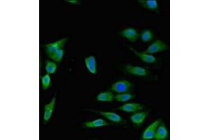 Immunofluorescent analysis of Hela cells using ABIN7150092 at dilution of 1:100 and Alexa Fluor 488-congugated AffiniPure Goat Anti-Rabbit IgG(H+L) (DISC1 antibody  (AA 99-325))