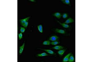 Immunofluorescent analysis of Hela cells using ABIN7150092 at dilution of 1:100 and Alexa Fluor 488-congugated AffiniPure Goat Anti-Rabbit IgG(H+L) (DISC1 antibody  (AA 99-325))