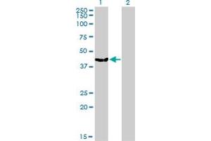 Western Blot analysis of MVD expression in transfected 293T cell line by MVD monoclonal antibody (M01), clone 2A7. (MVD antibody  (AA 301-398))