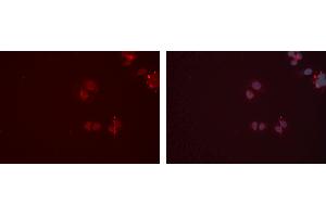 ABIN6277347 staining Hela cells by IF/ICC. (CPT2 antibody  (Internal Region))