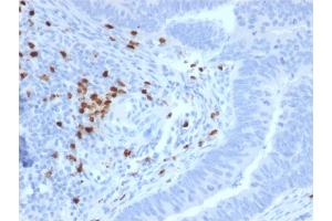 Immunohistochemistry (IHC) image for anti-Ret Proto-Oncogene (RET) (AA 702-848) antibody (ABIN6940507)