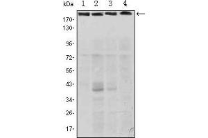 Western blot analysis using RICTOR mouse mAb against Hela (1), PANC-1 (2), MOLT4 (3), and HepG2 (4) cell lysate. (RICTOR antibody)