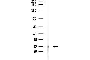 anti-Mitochondrial Ribosomal Protein L22 (MRPL22) (Internal Region) antibody