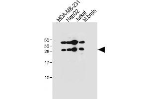 All lanes : Anti-EMX1 Antibody (C-term) at 1:1000 dilution Lane 1: MDA-MB-231 whole cell lysate Lane 2: HepG2 whole cell lysate Lane 3: Jurkat whole cell lysate Lane 4: Mouse brain tissue lysate Lysates/proteins at 20 μg per lane. (EMX1 antibody  (C-Term))