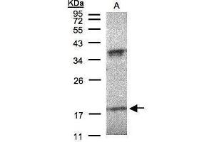 WB Image Sample(30 μg of whole cell lysate) A:H1299 12% SDS PAGE antibody diluted at 1:200 (IFNA6 antibody  (C-Term))