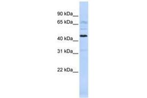 Image no. 1 for anti-Chromosome 22 Open Reading Frame 9 (C22orf9) (AA 288-337) antibody (ABIN6741293) (C22orf9 antibody  (AA 288-337))