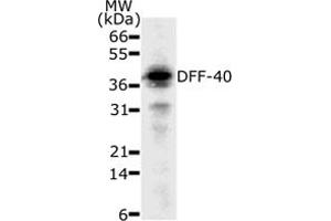 Western Blotting (WB) image for anti-DNA Fragmentation Factor, 40kDa, beta Polypeptide (Caspase-Activated DNase) (DFFB) (AA 205-222) antibody (ABIN208001) (DFFB antibody  (AA 205-222))