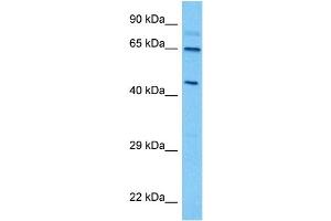 Host:  Mouse  Target Name:  THRA  Sample Tissue:  Mouse Spleen  Antibody Dilution:  1ug/ml (THRA antibody  (Middle Region))