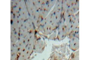 Used in DAB staining on fromalin fixed paraffin-embedded Heart tissue (NOSTRIN antibody  (AA 6-245))