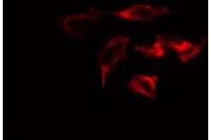 ABIN6275217 staining  Hela cells by IF/ICC. (Macrophage Mannose Receptor 1 antibody  (Internal Region))