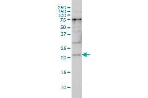 PRKRIP1 monoclonal antibody (M05), clone 4D11-3F11 Western Blot analysis of PRKRIP1 expression in Hela S3 NE . (PRKRIP1 antibody  (AA 1-184))