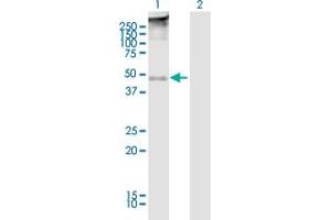 Western Blot analysis of TMEFF2 expression in transfected 293T cell line ( H00023671-T01 ) by TMEFF2 MaxPab polyclonal antibody. (TMEFF2 antibody  (AA 1-374))