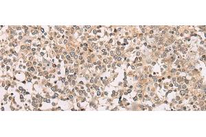 Immunohistochemistry of paraffin-embedded Human tonsil tissue using M1AP Polyclonal Antibody at dilution of 1:80(x200)