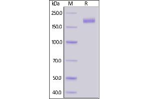 Biotinylated SARS-CoV-2 S protein, His,Avitag, Super stable trimer on SDS-PAGE under reducing (R) condition.