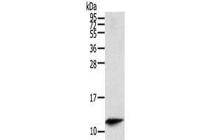 Western Blot analysis of Mouse spleen tissue using PBOV1 Polyclonal Antibody at dilution of 1/200 (PBOV1 antibody)